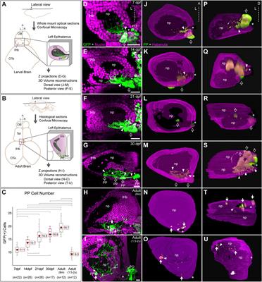 Ontogenesis of the asymmetric parapineal organ in the zebrafish epithalamus